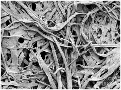Filtering Cellulose Microimage